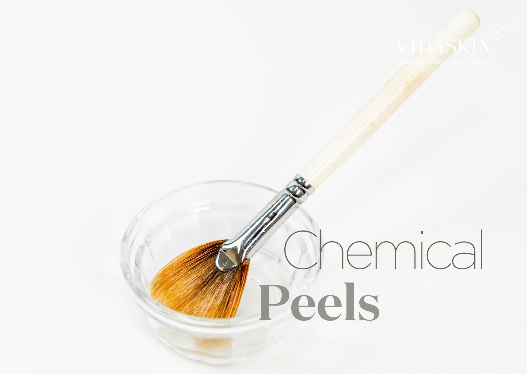 Understanding the Different Types of Chemical Peels