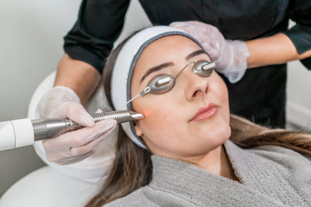 Beauty laser technician performing a cosmetic skin resurfacing session on a female patient, also called a laser peel or photofacial, with an Er:Yag laser (infrared wavelength).