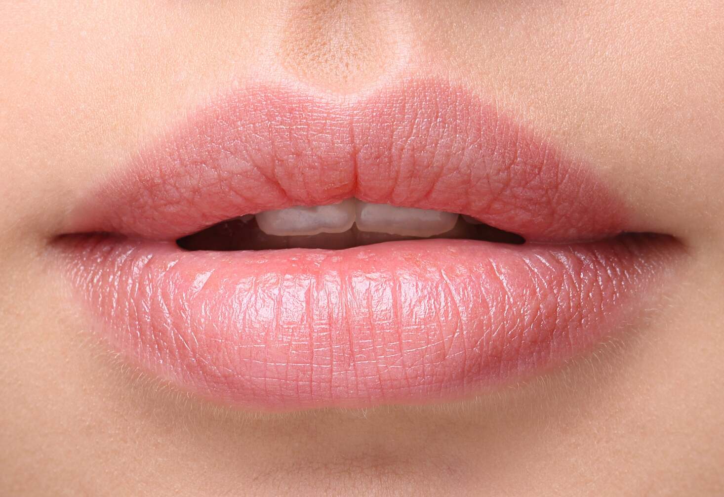 Close-up of natural-looking, plump lips after the best lip filler treatment for enhanced shape and volume.
