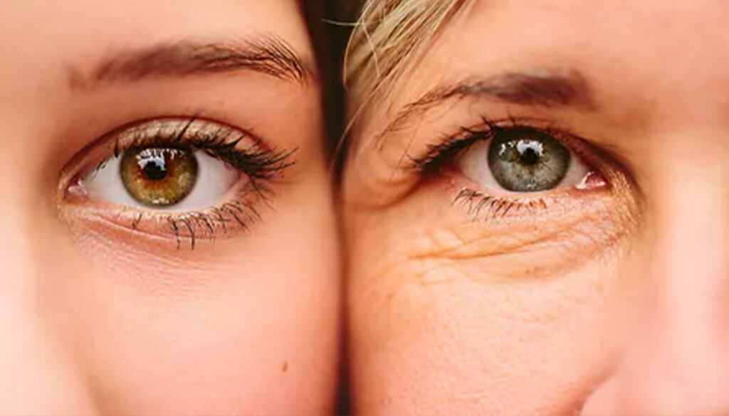 Woman’s face showing visible signs of ageing, highlighting the need for layered rejuvenation treatments.