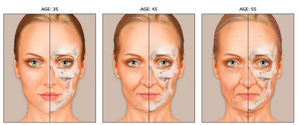 Illustration showing facial changes at ages 35, 45, and 55, highlighting signs of aging and the importance of facial rejuvenation treatments