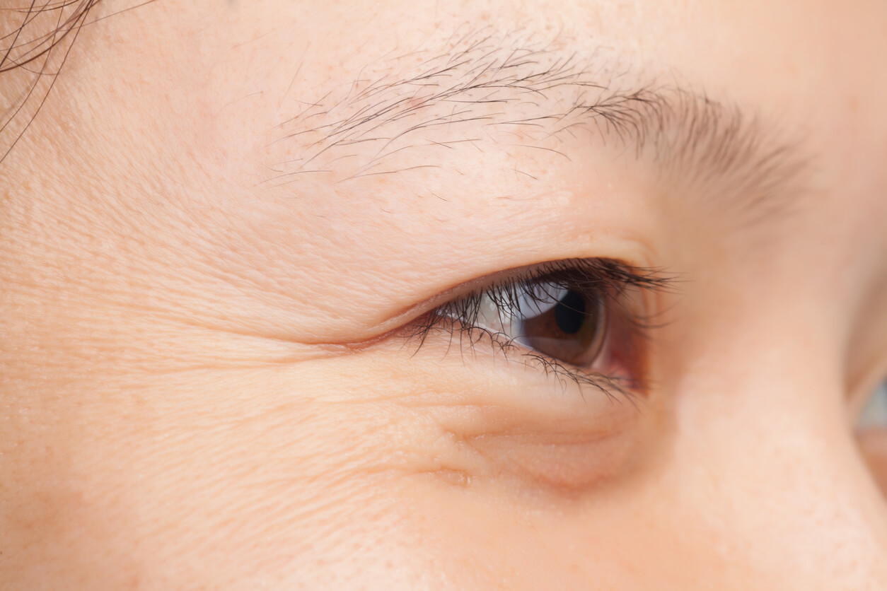 Close-up of a woman's eye area showing visible results of Under Eyes Treatment for dark circles and puffiness.