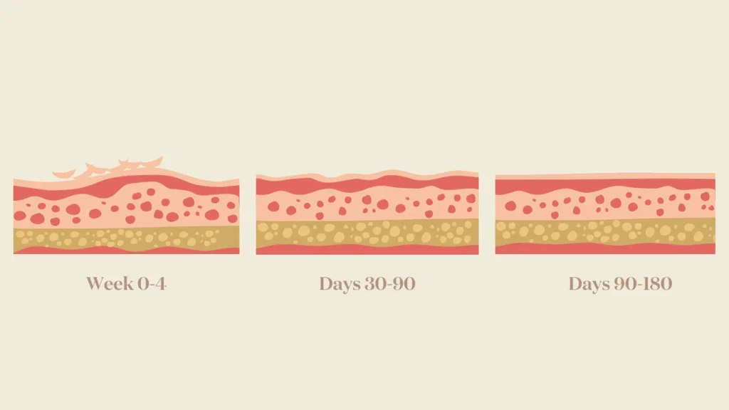 Chart of the collagen maturation cycle showing the thickening and alignment of fibers over 180 days.