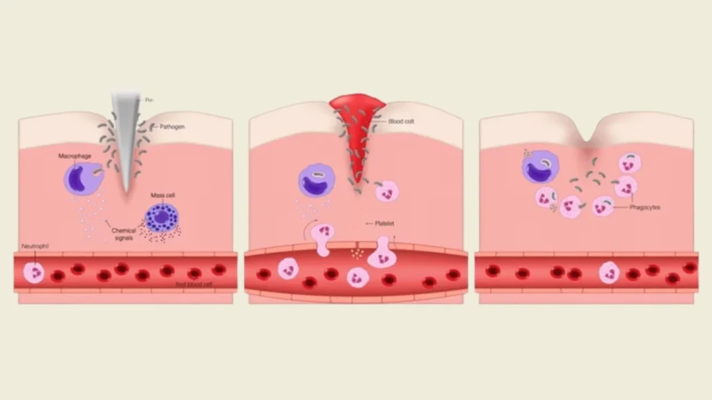 Image depicting how the immune system completes that pigmentation repair after the treatment