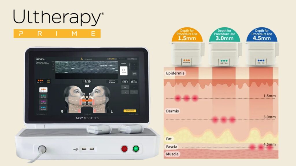 Ultherapy Prime system display showing real-time tissue imaging and the three targeted treatment depths (1.5mm, 3mm, 4.5mm).
