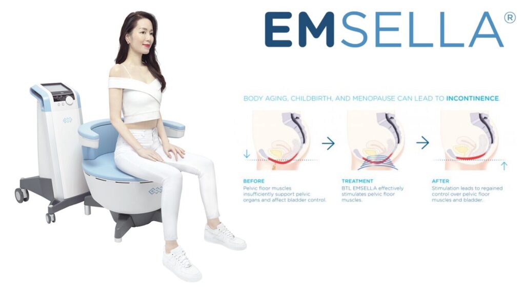 A diagram showing a woman sitting on the Emsella chair and the resulting regained control of pelvic floor muscles