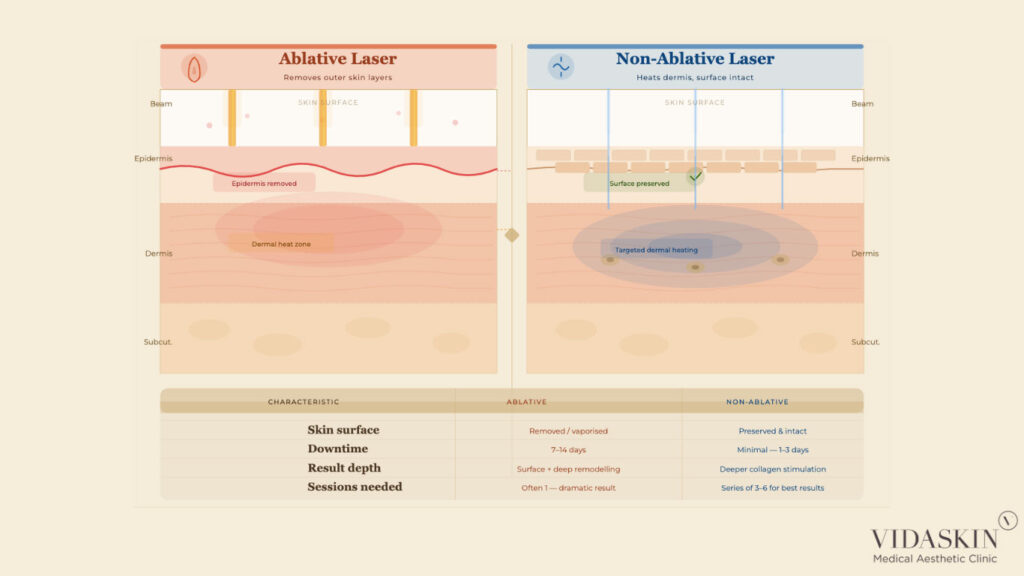 Technical comparison between ablative laser (vaporizing tissue) and non-ablative laser (heating dermis).