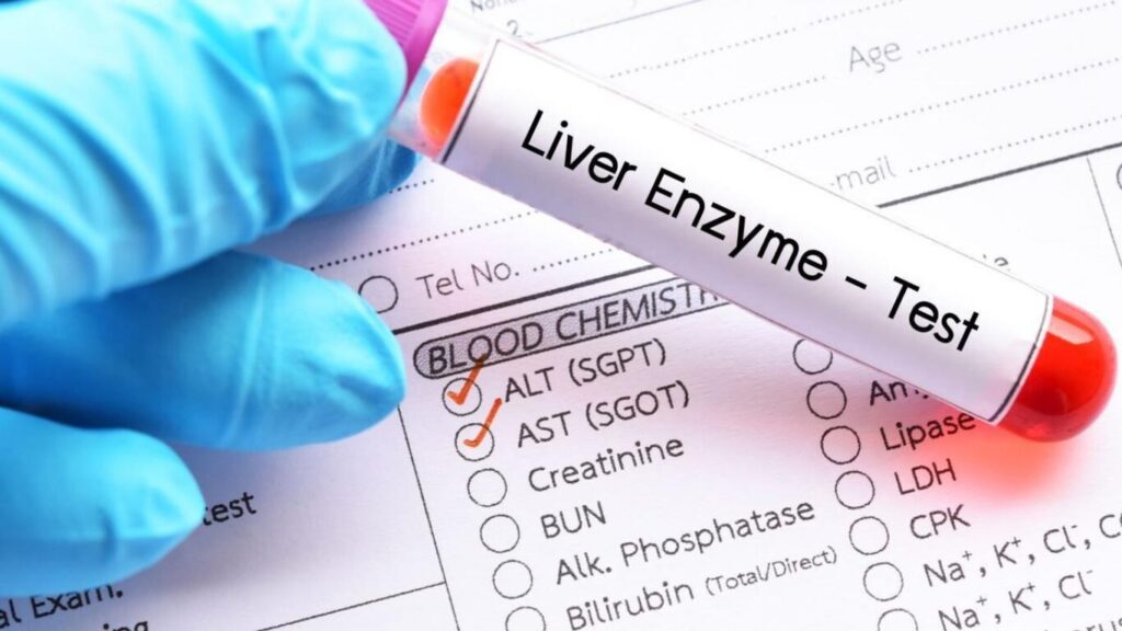 Blood test vial