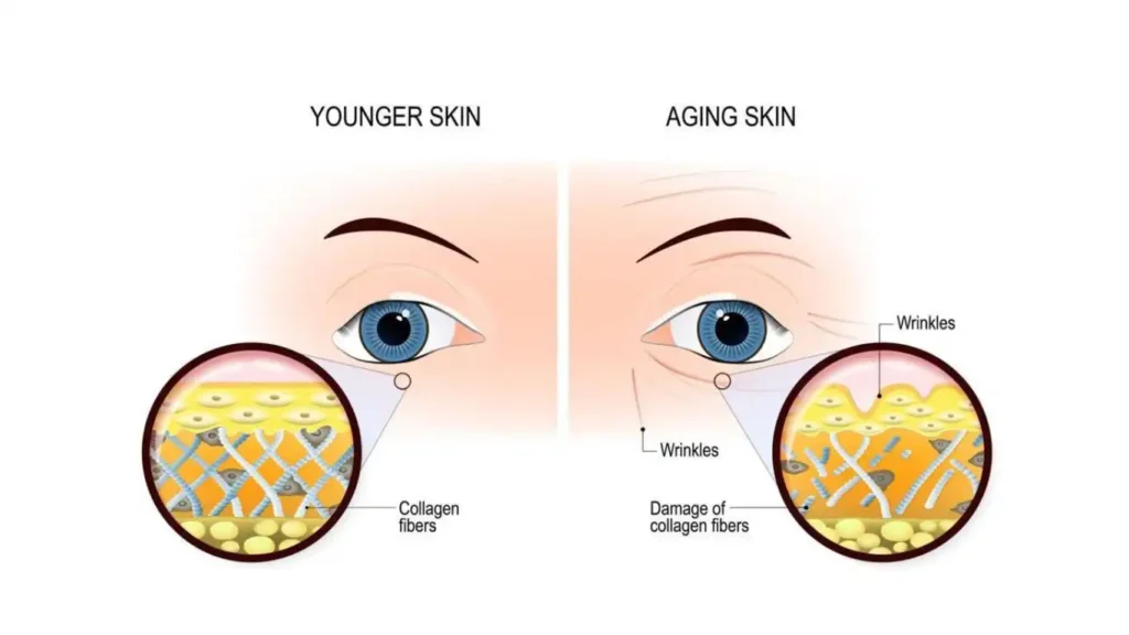 Causes of facial sagging