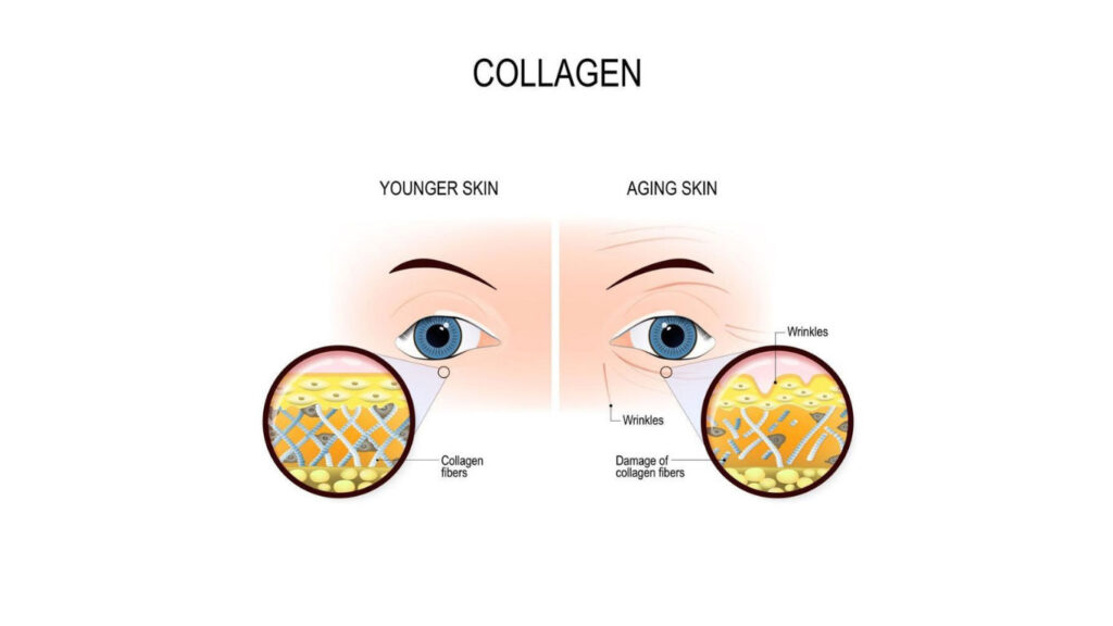 Causes of sagging eyelids and brow droop