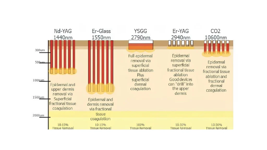Choosing the right laser depends on individual skin needs.