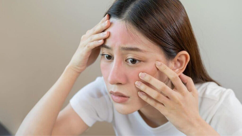 Redness and swelling on a woman’s face