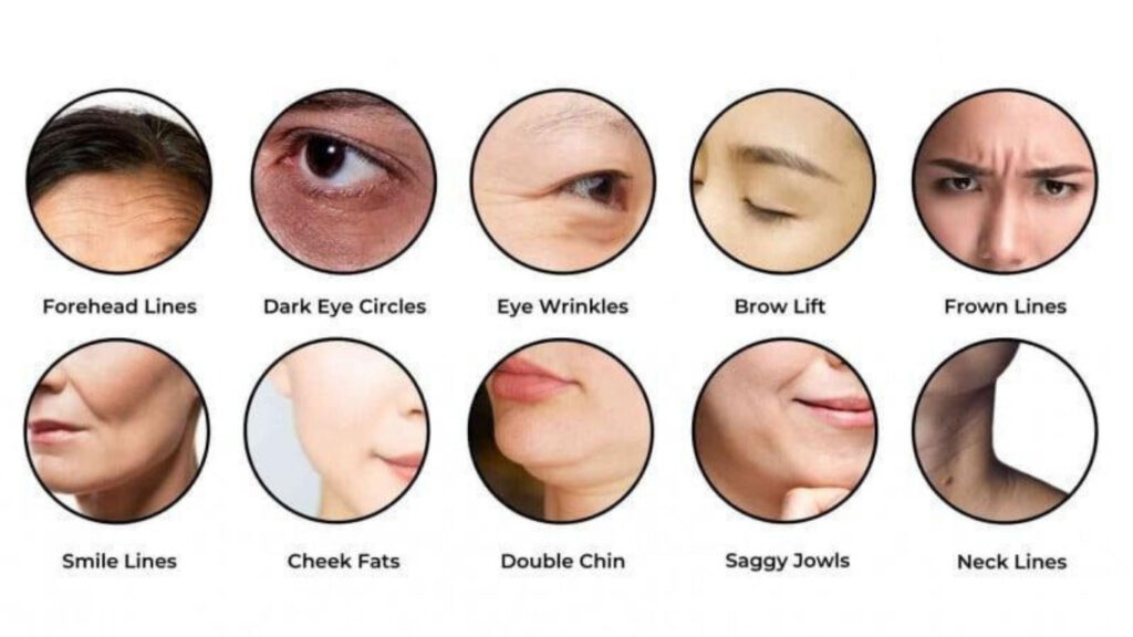 Skin issues that Radiofrequency-based treatments tackle