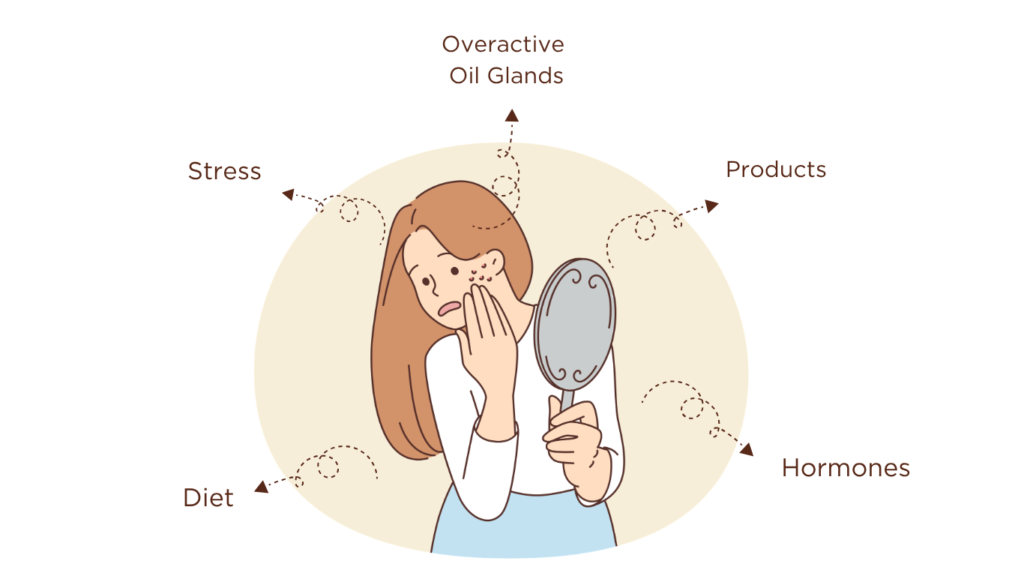 Acne common triggers