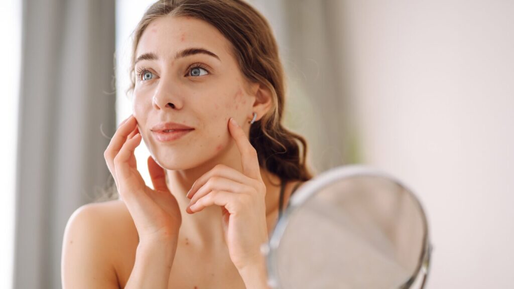 Woman checking her face for acne
