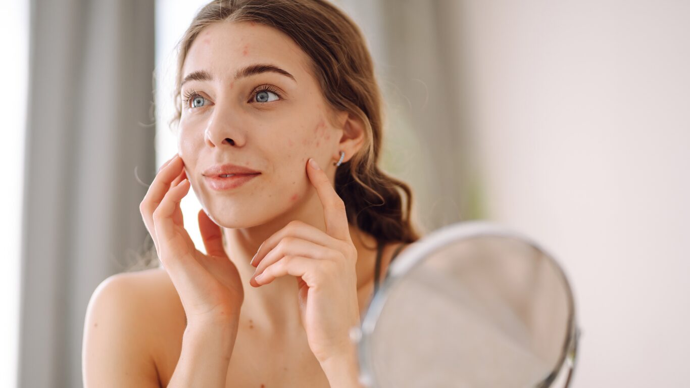 Woman checking her face for acne