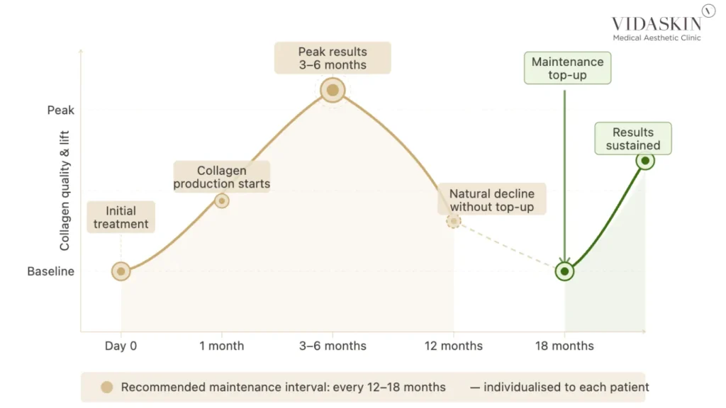 Ultherapy maintenance cycle