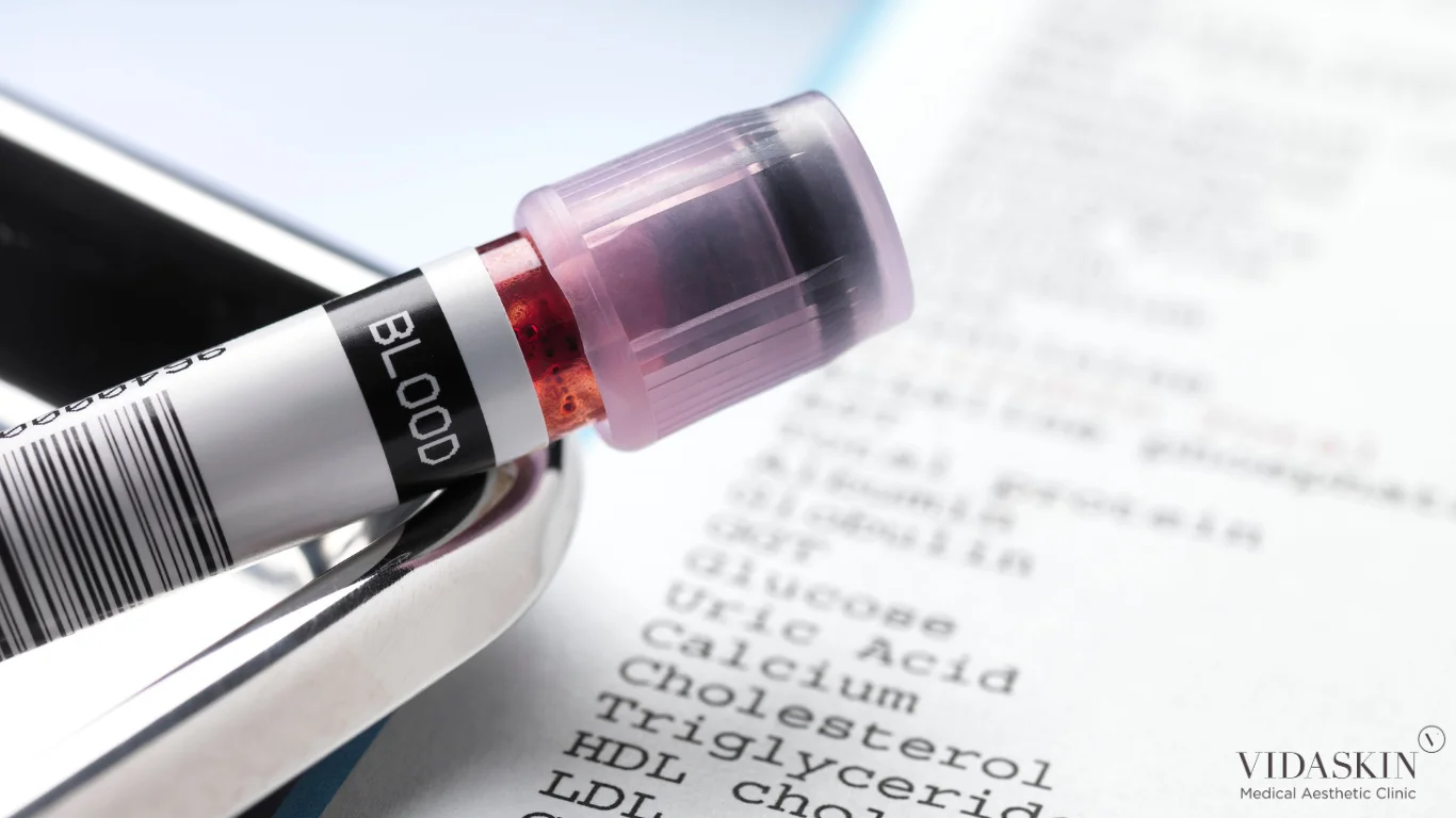 Blood sample tube resting on a printed laboratory report sheet