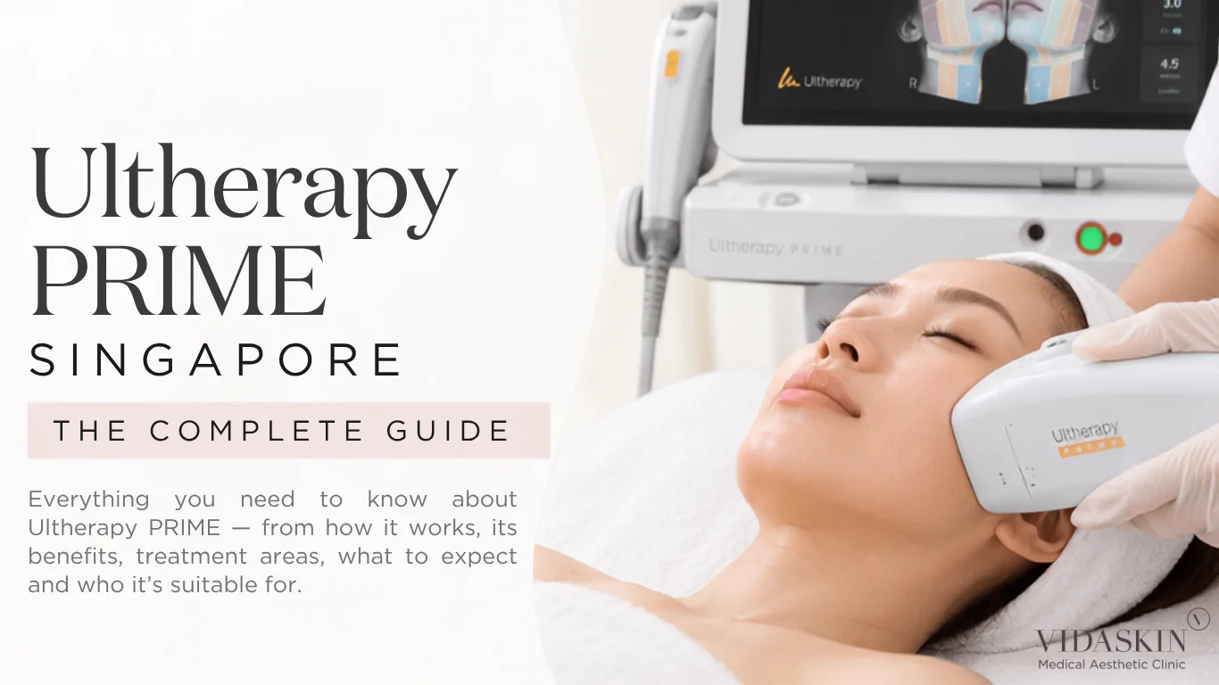 Ultherapy Prime complete guide